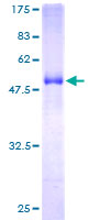 Recombinant Human EPDR1 protein