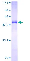 SDS-PAGE - Recombinant Human EPDR1 protein (GST tag N-Terminus) (AB162830)