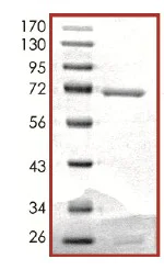 SDS-PAGE - Recombinant human Eph receptor A1/EphA1 protein (AB101778)