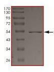 SDS-PAGE - Recombinant human Eph receptor A1/EphA1 protein (AB206006), expandable thumbnail