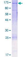 Recombinant Human Eph receptor A2 protein