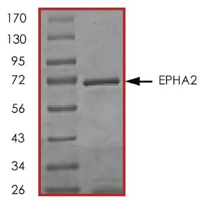 SDS-PAGE - Recombinant human Eph receptor A2 protein (Active) (AB268528)