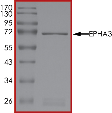 SDS-PAGE - Recombinant human Eph receptor A3 protein (AB84576), expandable thumbnail