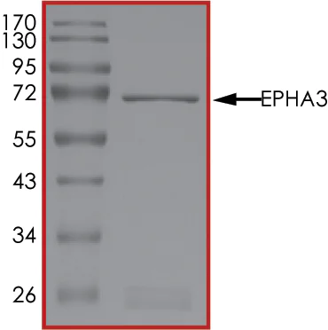 SDS-PAGE - Recombinant human Eph receptor A3 protein (AB84576)