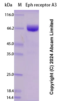 SDS-PAGE - Recombinant Human Eph receptor A3 Protein Standard (His tag) (AB323058)