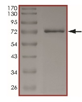 SDS-PAGE - Recombinant human Eph receptor A4/SEK protein (AB206013), expandable thumbnail