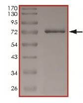SDS-PAGE - Recombinant human Eph receptor A4/SEK protein (AB206013)