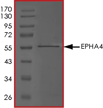 SDS-PAGE - Recombinant human Eph receptor A4/SEK protein (AB84575)