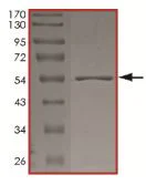 SDS-PAGE - Recombinant human Eph receptor B2 protein (AB205990)