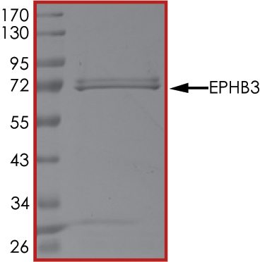 SDS-PAGE - Recombinant human Eph receptor B3 protein (AB51409), expandable thumbnail