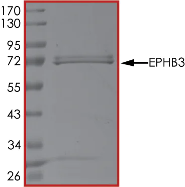 SDS-PAGE - Recombinant human Eph receptor B3 protein (AB51409)