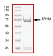 SDS-PAGE - Recombinant human Eph receptor B3 protein (AB51409), expandable thumbnail