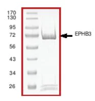 SDS-PAGE - Recombinant human Eph receptor B3 protein (AB51409)