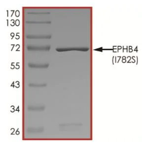 SDS-PAGE - Recombinant Human Eph receptor B4/HTK (mutated I782S) protein (Tagged) (AB268531)