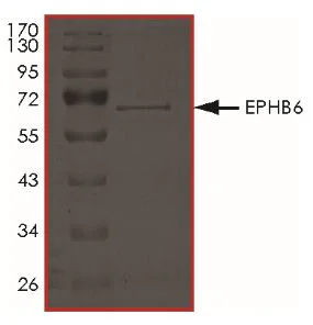 SDS-PAGE - Recombinant Human Eph receptor B6 protein (Tagged) (AB268532)