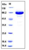 SDS-PAGE - Recombinant human Eph receptor B6 protein (His tag) (AB276223)