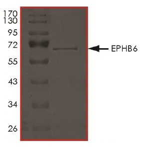 SDS-PAGE - Recombinant Human Eph receptor B6 protein (Tagged) (AB268532)