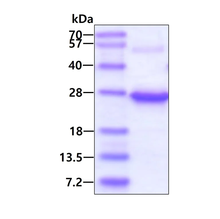 SDS-PAGE - Recombinant Human Ephrin A1 protein (denatured) (His tag N-Terminus) (AB113867)