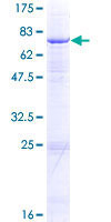 SDS-PAGE - Recombinant Human Ephrin A2 protein (AB114898)