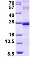 SDS-PAGE - Recombinant Human Ephrin A3 protein (denatured) (His tag N-Terminus) (AB156351)