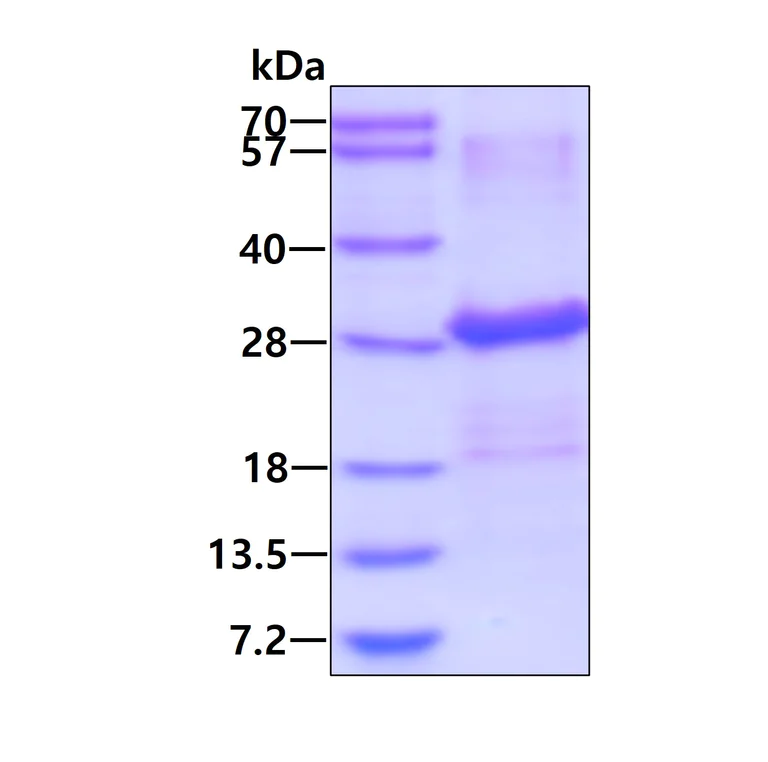SDS-PAGE - Recombinant Human Ephrin B2 protein (AB113609)
