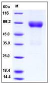 SDS-PAGE - Recombinant human Ephrin B2 protein (Fc Chimera His Tag) (AB276332), expandable thumbnail