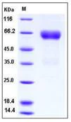 SDS-PAGE - Recombinant human Ephrin B2 protein (Fc Chimera His Tag) (AB276332)