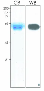 SDS-PAGE - Recombinant Human Ephrin B2 protein (AB92862)
