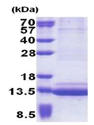 SDS-PAGE - Recombinant Human Epigen protein (denatured) (His tag N-Terminus) (AB171696)