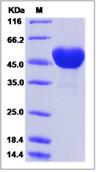 SDS-PAGE - Recombinant Human Epiphycan protein (His tag) (AB276595)