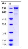 SDS-PAGE - Recombinant Human EPO-R + IL-3RB protein (Fc Chimera) (AB277025)
