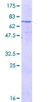 SDS-PAGE - Recombinant Human Epoxide hydrolase protein (AB114694)