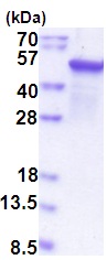 SDS-PAGE - Recombinant Human Epoxide hydrolase protein (denatured) (AB177622)
