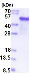 SDS-PAGE - Recombinant Human Epoxide hydrolase protein (denatured) (T7 tag N-Terminus) (AB177622)