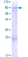 Recombinant Human EPS8L1 protein
