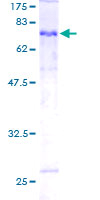 SDS-PAGE - Recombinant Human epsilon Tubulin protein (GST tag N-Terminus) (AB162445)