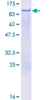 SDS-PAGE - Recombinant Human Epsin 1 protein (GST tag N-Terminus) (AB162265)