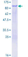 SDS-PAGE - Recombinant Human Epsin 1 protein (GST tag N-Terminus) (AB162265)