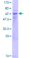 SDS-PAGE - Recombinant Human ERAP2 protein (AB163795)