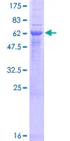SDS-PAGE - Recombinant Human ERAP2 protein (GST tag N-Terminus) (AB163795)