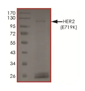 SDS-PAGE - Recombinant Human ErbB2 / HER2 (mutated E719K) protein (Tagged) (AB268626)
