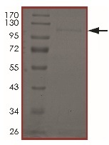 SDS-PAGE - Recombinant human ErbB2 / HER2 (mutated G776V + G776C) protein (Cytoplasmic domain) (AB191466), expandable thumbnail