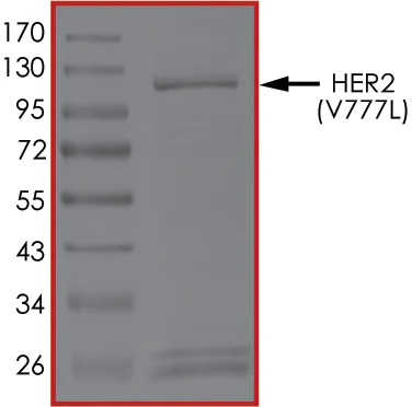 SDS-PAGE - Recombinant human ErbB2 / HER2 (mutated V777L) protein (AB207945)