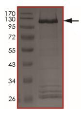 SDS-PAGE - Recombinant human ErbB2 / HER2 (mutated V777L) protein (AB207945), expandable thumbnail