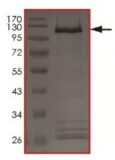 SDS-PAGE - Recombinant human ErbB2 / HER2 (mutated V777L) protein (AB207945)