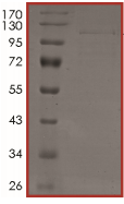 SDS-PAGE - Recombinant human ErbB2 / HER2 protein (AB190418), expandable thumbnail