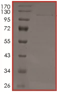 SDS-PAGE - Recombinant human ErbB2 / HER2 protein (AB190418)