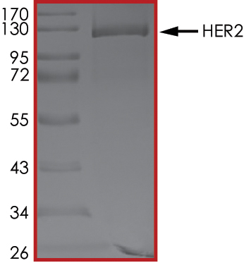 SDS-PAGE - Recombinant human ErbB2 / HER2 protein (AB190418), expandable thumbnail