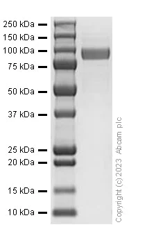 SDS-PAGE - Recombinant Human ErbB2 / HER2 protein (AB310794)