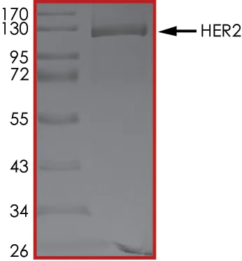 SDS-PAGE - Recombinant human ErbB2 / HER2 protein (Active) (AB60866)
